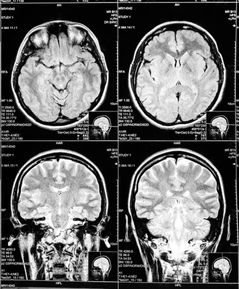 MRI Service Brain