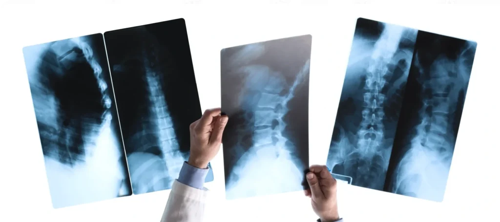 xray hook image