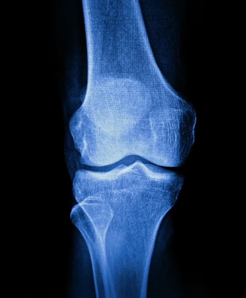 xray service item 1