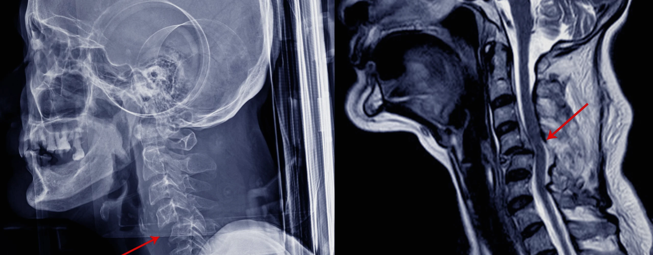 Auto Accident Injury MRI Winter Garden 6