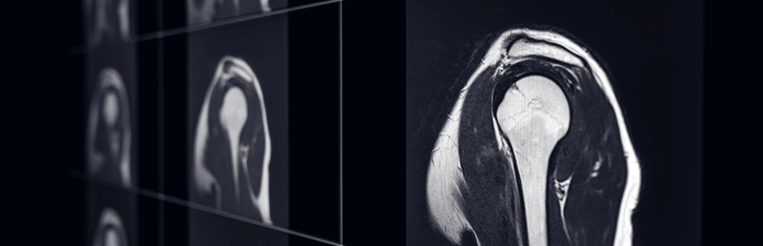 Athletic Injury MRI Winter Garden 9